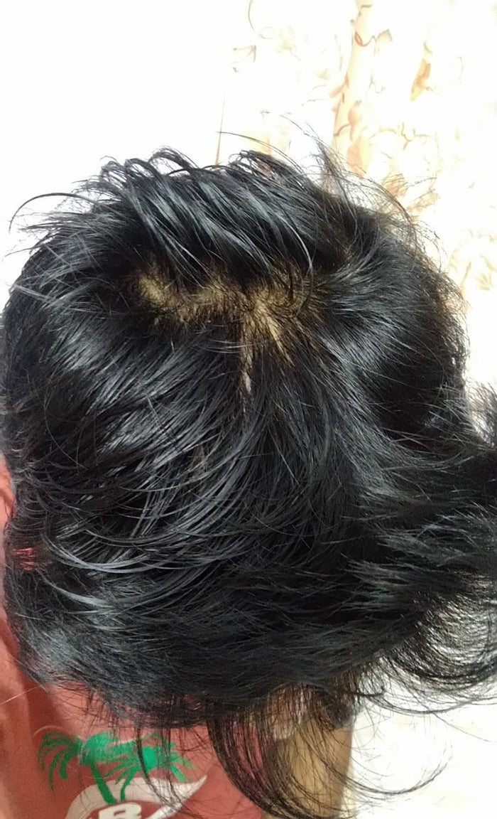 After