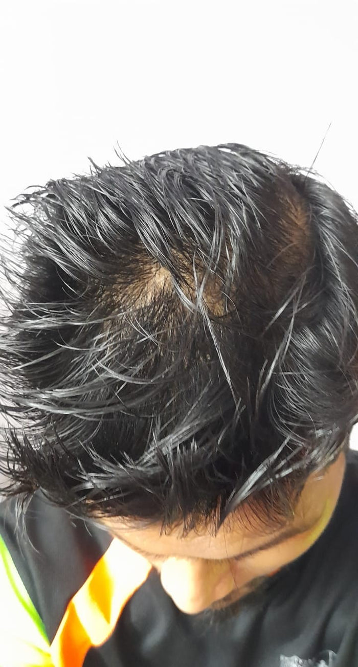 Before